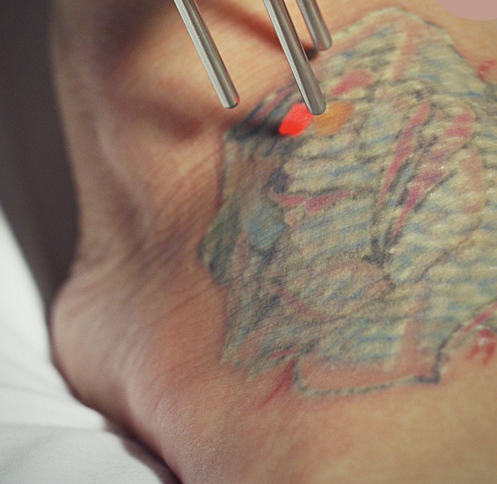 A picture of a facial being performed